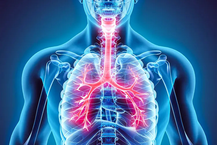 Bronchitis