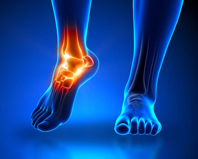 Gout