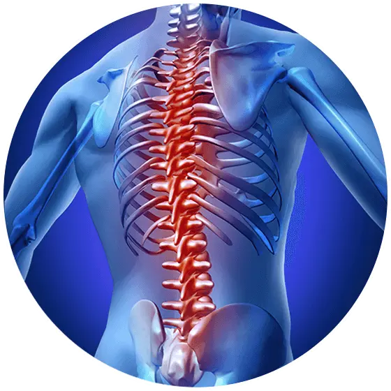 Spondylosis